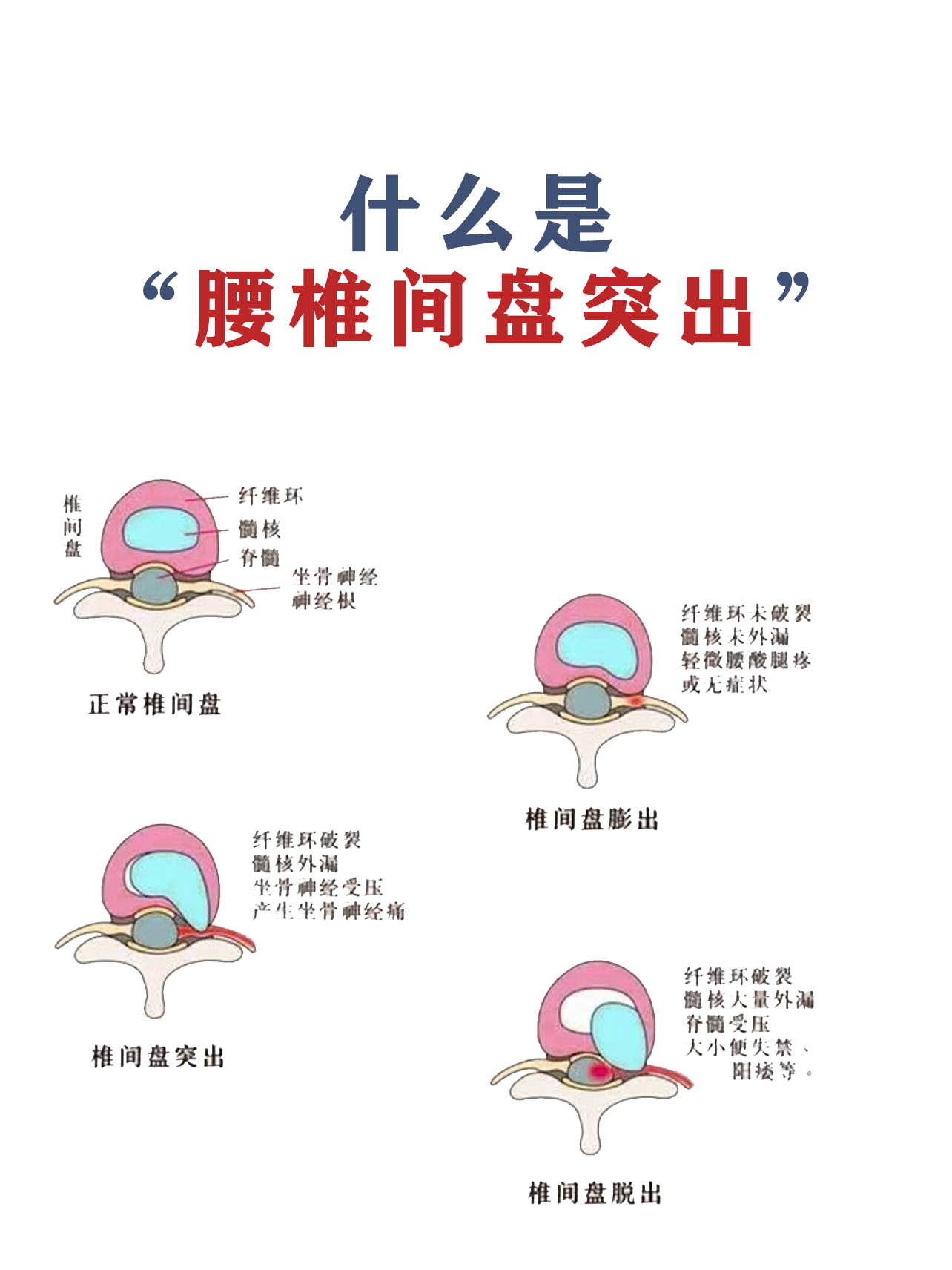 67c05737250f71d94284057abfe214b0.png